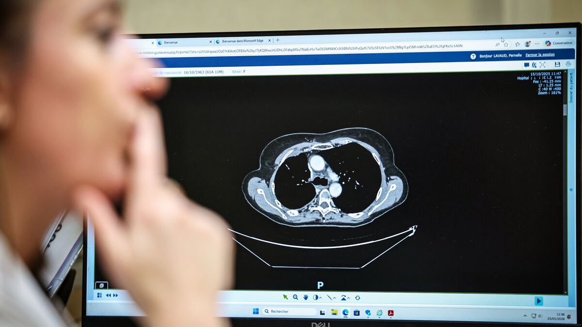 Dépistage du cancer du poumon : participez à l'action qui pourrait sauver des vies